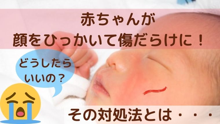 顔がかゆいの 赤ちゃんが顔をひっかいて傷だらけに その対処法とは 子育てのメモ帳